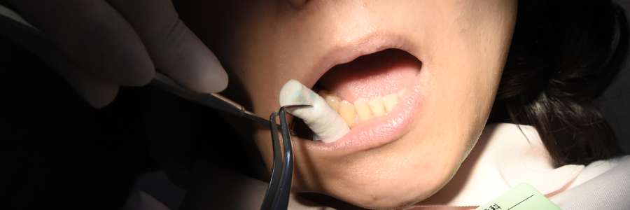 歯医者が怖い理由はコレ 歯科医師として歯医者が怖い理由を真剣に考えてみました 千早駅 陽だまり歯科